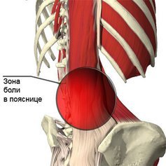 Специальные упражнения при болях в пояснице