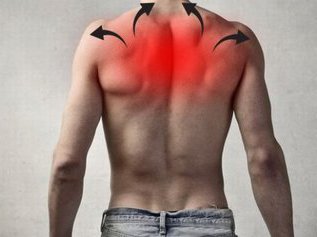 Прострел в пояснице, шее, под лопаткой: а если виноват фитнес?
